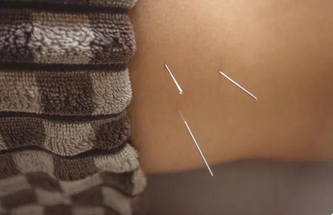 Traditional Chinese Medicine